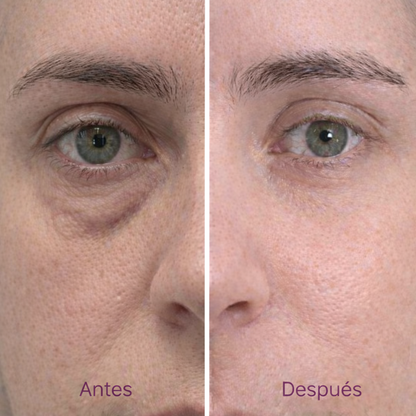 Lumina — El Bálsamo #1 Para Cara Deflactada y Cansada